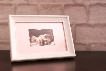 Photo ultrasound image in the frame is on the table. Soft focus.