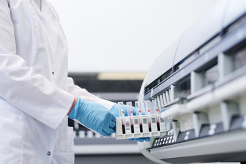 Close-up of unrecognizable laboratory technician in white coat and sterile gloves putting blood...