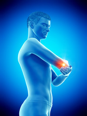 3d rendered medically accurate illustration of a painful elbow
