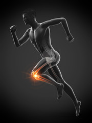 Obraz premium 3d rendered medically accurate illustration of a runners painful knee