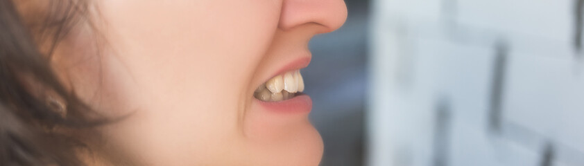 Photo of crooked woman teeth