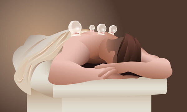 The man on the cupping therapy session illustration for web and print. Male athlete relaxing on massage table with cups on his back for his muscles recovery. Sports medicine and recuperation concept.