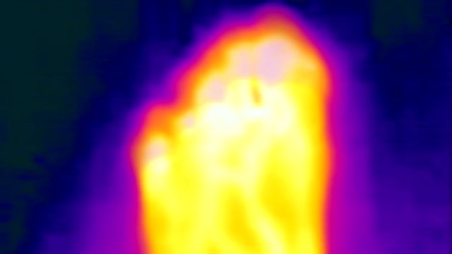 Thermal Video Images Of Left Food With Veins Blood Vessels And Toes Moving Curling Back And Forth
