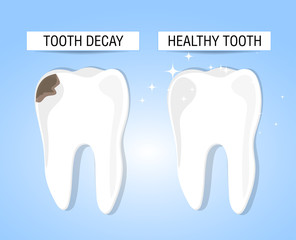The concept of healthy and diseased tooth. Visual aid for students, dentists, patients of the clinic. Defeat caries, the focus of destruction in the teeth. Vector illustration