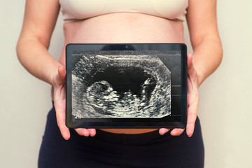 Pregnant woman shows a picture of a baby ultrasound scan on a tablet. Healthy pregnancy. Concept of...