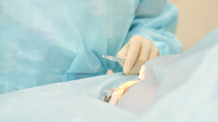 Ophthalmology laser microscope operation. Doctor in clinic. Patient eye treatment. Myopia and...
