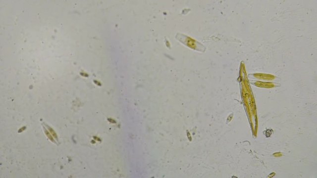 Diatoms in creek water