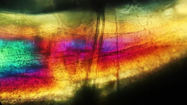 Amphipod circulation at 100x with hemolymph flow.