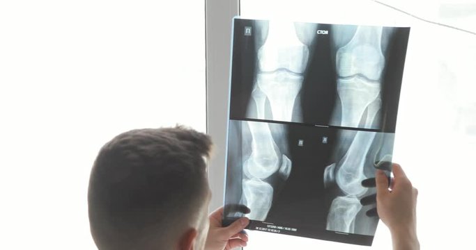 Man doctor orthopedic surgeon diagnostics damage of bones on x-ray images roentgen standing near the window, back view.