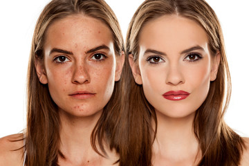 Comparison portrait of young beautiful woman before and after skin treatment and makeup on white...