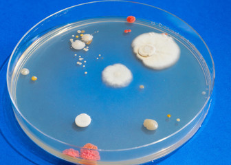 Bacteria colonies in petri dish