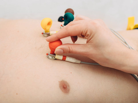 patient getting heart rate monitored at hospital. Close-up Of Ecg electrode
