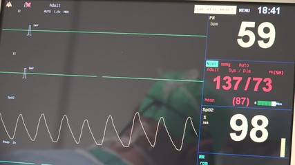 A heart rate monitor (HRM) is a personal monitoring device that allows one to measure/display heart rate in real time or record the heart rate for later study.  - Powered by Adobe