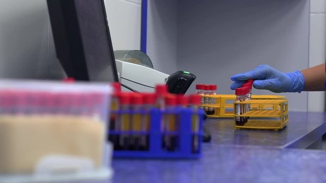 Hand of a lab technician holding blood tube test. Rack of color tubes with blood samples other patients. Laboratory technician holding a blood tube test with code bar.