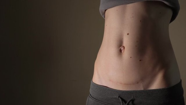 C section Cesarean operation heal after mother holding baby postpartum recovery