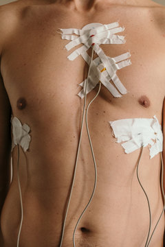 Man wearing mobile holter cardio monitor