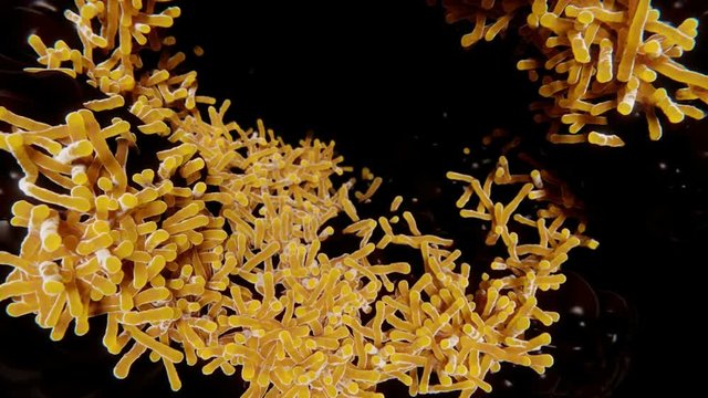 Tuberculosis bacillus in the lung. Tuberculosis is an infectious disease caused by the bacterium Mycobacterium tuberculosis. In 90 % of cases it affects the lungs. 