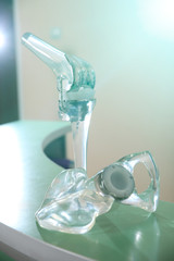 Hip replacement implant installed in the pelvic bone