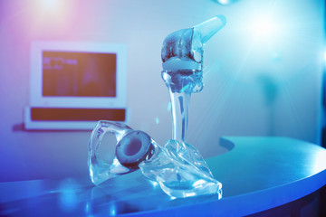 Hip replacement implant installed in the pelvic bone