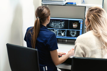 Female doctor shows the patient an x-ray image at display. Computer diagnostics dental tomography. Planning teeth treatment in modern dental clinic