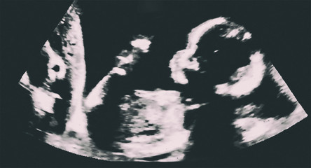 Obraz premium Ultrasound of baby inside mother's womb. Ultrasonography, echography of pregnant woman. Maternity and pregnancy concept