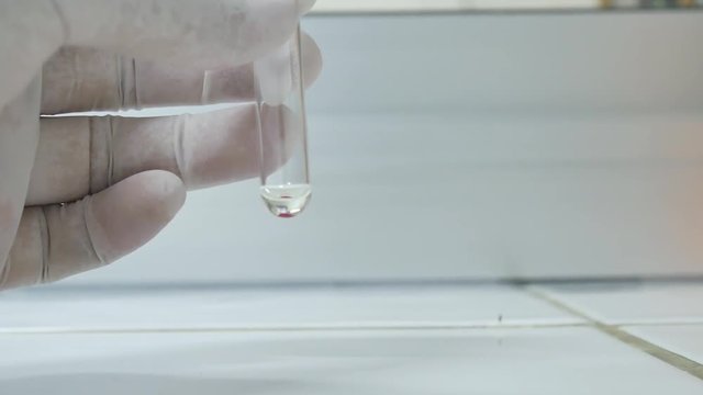Test tube blood group testing in laboratory science concept.