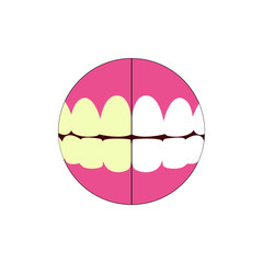 EPS 10 vector. Teeth whitening advertisement. Before and after.