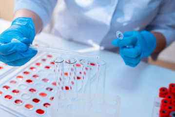 Laboratory determination of blood type. Blood test