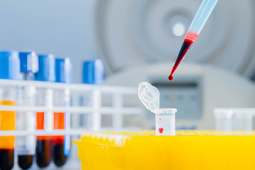 Dna test in the lab. Dispenser with blood and test tubes close-up. A drop of blood