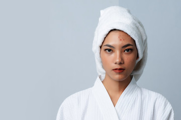 Comparison Portrait of Beautiful Asian woman. Dark spots and new skin, Before - After skin care and...