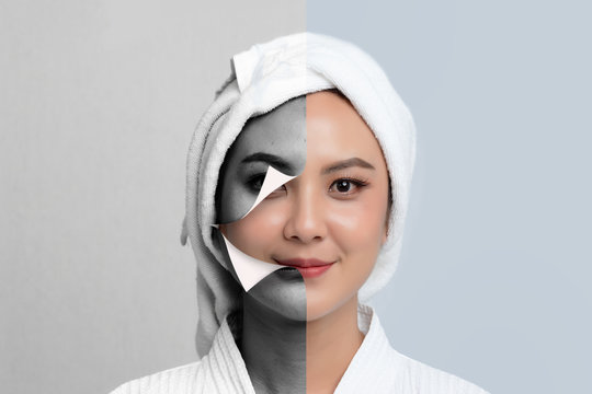 Comparison Portrait of Beautiful Asian woman. Dark spots and new skin, Before - After skin care and clean concept, Beauty treatment process of aging for rejuvenation.
