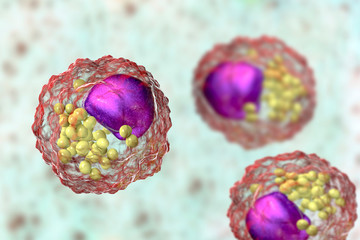 Foam cells, macrophage cells that contain lipid droplets and are components of atherosclerotic plaque, 3D illustration