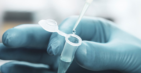 sample tubes in female hands and pipette