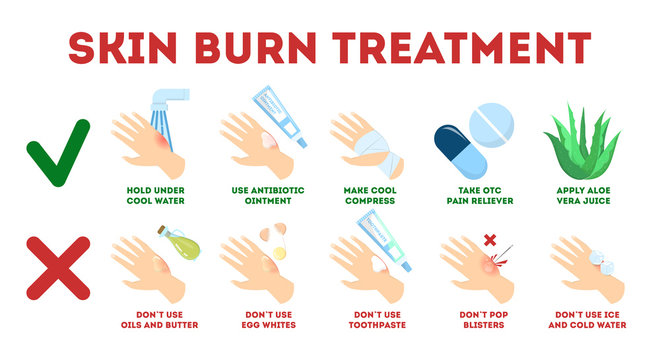 Skin burn injury treatment infographic. First aid for damage