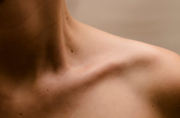 Clavicle Women with moles on the skin - obrazy, fototapety, plakaty