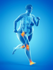 3d rendered medically accurate illustration of the painful joints of a running obese woman