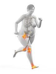 3d rendered medically accurate illustration of the painful joints of a running obese woman