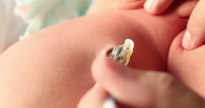 Mother cleaning newborn baby umbilical cord after birth, first week of infant life