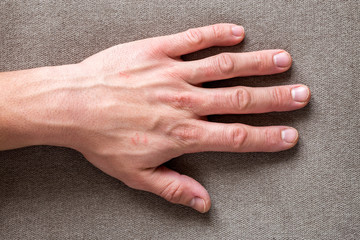 Close-up of male masculine worker hand with rough skin and short fingernails resting on flat copy space background, top view. Manual labor and hands care concept.