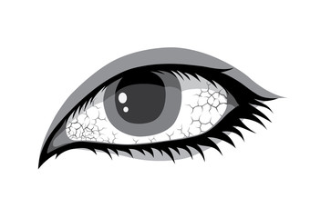 Red eye or cracked. Blood vessels and eyeball in cartoon vector style. Health concepts.