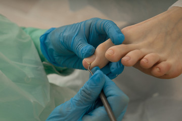 Podologist making procedure with nails. Podology. Footcare - obrazy, fototapety, plakaty