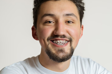 Portrait of a young man with braces smiling. A happy young man with braces on a white background