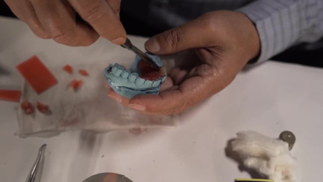 Dental wax modelling upper jaw on the cast of removable partial denture, close up shot