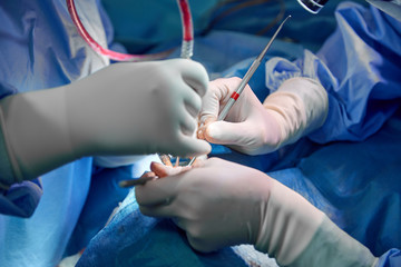 Surgeon and his assistant performing cosmetic surgery on nose in hospital operating room. Nose...