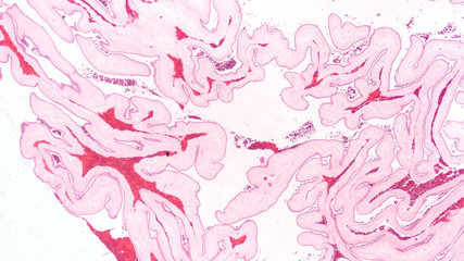 Fototapeta na wymiar Natural art: a cross section of human placental membranes, with an unusual folding pattern.