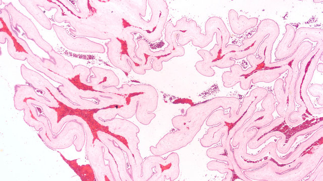 Natural art: a cross section of human placental membranes, with an unusual folding pattern.