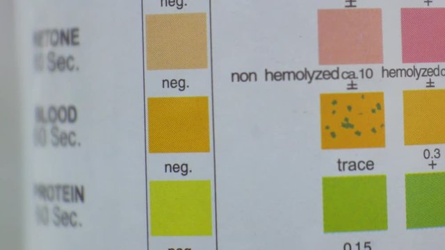 Urine analysis in laboratory.