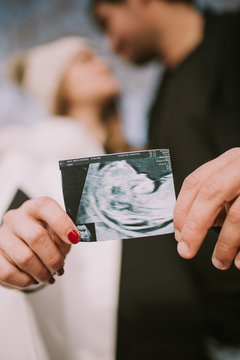 ultra sound pregnacy