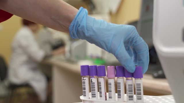 A close-up of medical technologist taking out blood test tubes from hematology analyzer. Completed tests. Blurred background. Scientific and healthcare research concept