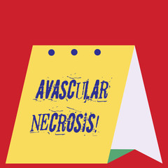 Writing note showing Avascular Necrosis. Business concept for death of bone tissue due to a lack of blood supply Modern fresh design of calendar using hard paper material